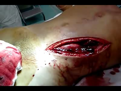 Stomach Sliced Perfectly Open While Guy Breathes is Pretty fucking Creepy