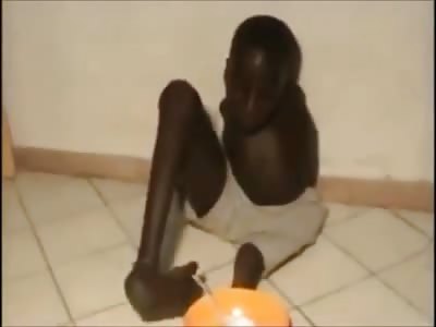 Black boy with Bizarre Deformity still makes the Most out of Life