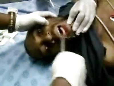 WTMF: Doctors Remove a Cell Phone from a Mans Throat in Hospital Room