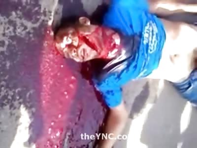 The Perfect Death Stare..man Murdered with Single Machete Blow to the Face Bled out in the Street