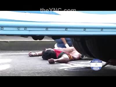 Man is Twisted up Like a Pretzel after Being hit by Truck
