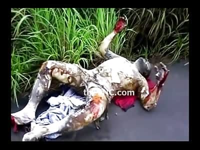 Man in Extreme Agony with Skin Melting Off on the Side of the Road (Recently from Brazil) 
