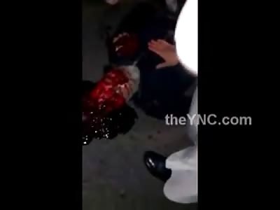 Man with his Head Literally Exploded Still in Total Agony on the Ground
