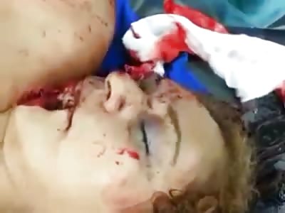 Woman with Half of her Face Destroyed still Alive in Emergency Room