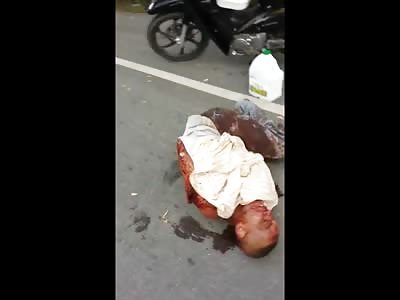 Man Chopped up by Machete in Total Agony After Being Robbed of his Motorcycle