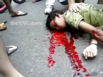 Poor Little Kid Bleeds Out on the Street after Being Runover