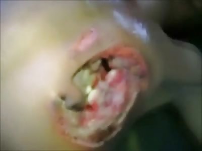 See a Man's Heart Beating through his Chest with this Disgusting Open Wound