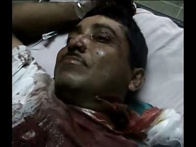 Man with Machete Gashes All Over Gets His Neck Stitched up