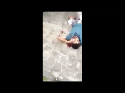 Man Shot in the Face Bleeds out and Agonizes before Death