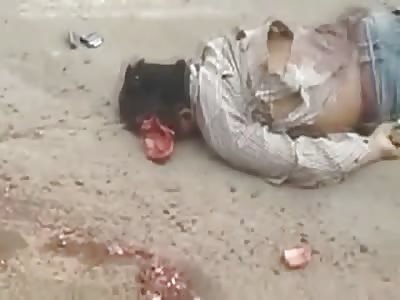 Poor Man Lays Next to his Brains after Terrible Accident that Killed him on Impact
