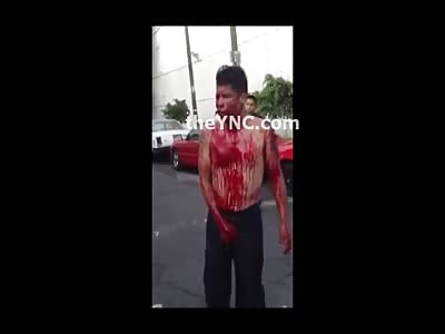 You Should See the Other Guy....Stabbing Victim Walks around in a Daze 