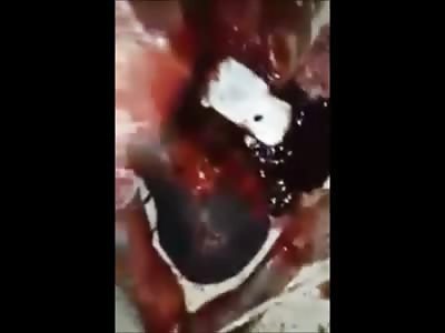 Man Choking,  Gasping for Air Lying in his Own Blood after Brutal Lynching