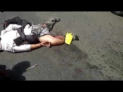 Rider in the Very Last Moments of Life After Being Dragged by a Truck