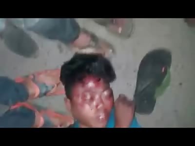Kid is Savagely Beaten by Crowd for Stealing