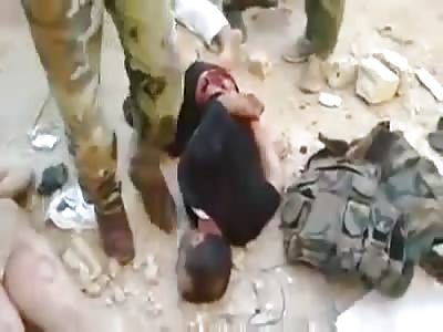 Assad Gangs Torture Civilians!! 1 Guy Gets his Teeth Collected!!!