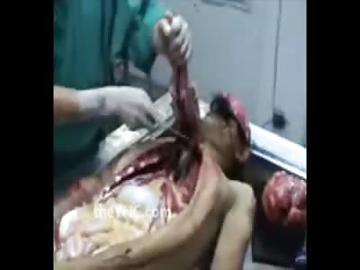 Morgue in Thailand: Video Shows the Autopsy of a Man (End of the Video Reveals His Last Meal)
