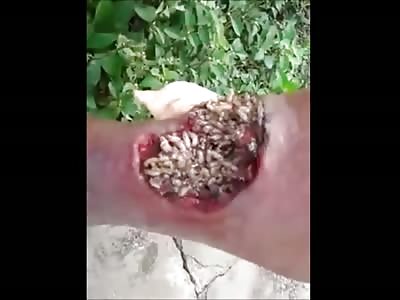 Fresh Wound turns into Fully Festering Maggot Infestation 