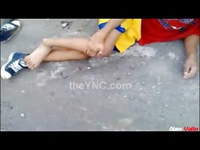 Kid in Full Blown Agony Ankle Twisted