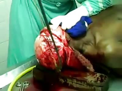 SHOCKING! Using a Hand Saw and Crowbar to Open Human Skull to Remove the Brain
