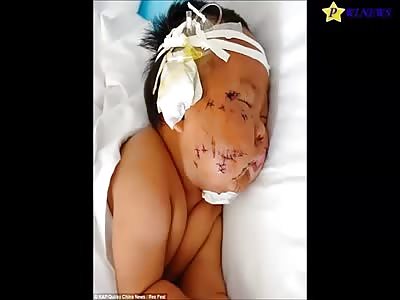 OMG - Chinese Mother Stabbed Her Baby Almost 100 Times with Scissors Because He Bit Her Breast while Getting Breastfed