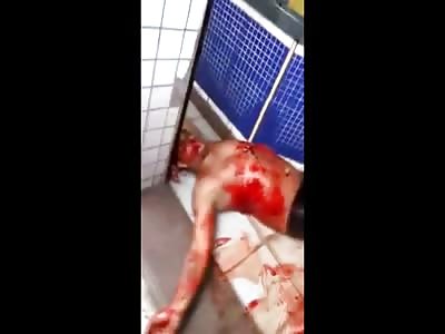 Dude Shot Multiple Times Agonizes in Total Pain and Suffering 
