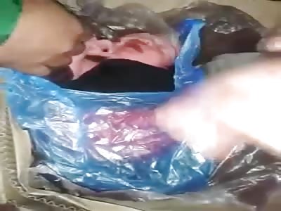 Newborn Baby Left to Die Inside a Garbage Can is Saved