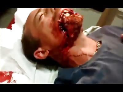 Crazy Jilted Woman Bit this Dudes Lip off and Stabbed Him in the Face