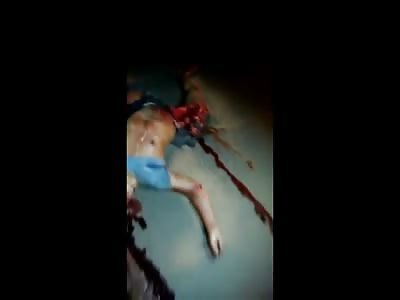 Rider With his Head Opened and Leg Ripped Apart after Accident