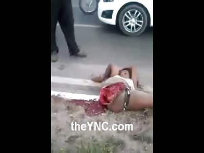 Shocking Video Shows Girls Leg Ripped Off at the Crotch With her Still Alive