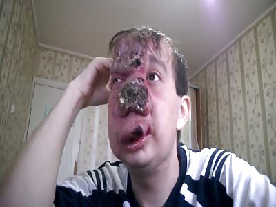 Man Suffering From A Terrible Disease
