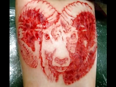 Scarification