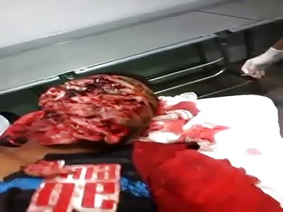 Brazilian drug dealer enters into a shootout with the police and get a rifle shot in the face.