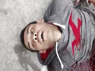 *BRAZIL* 2 robbers SHOT and agonizing on their last moments of life.
