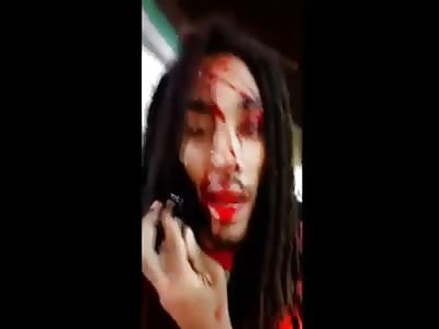 American Rapper Shot in Head with AK-47, Makes Selfie Video Moments After