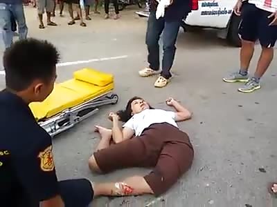 Injured woman with broken legs and twisted hips dying. 