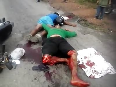Man in Total Agony With His Knee Destroyed After Motorcycle Accident