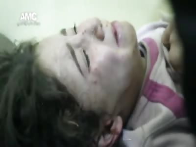 Children suffer the most in War Aleppo Suriya