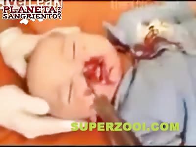 Baby stabbed in face