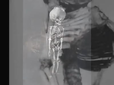 Mutter Museum Inventory.